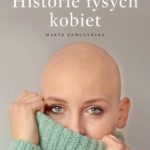 ALOPECJANKI – historie łysych kobiet